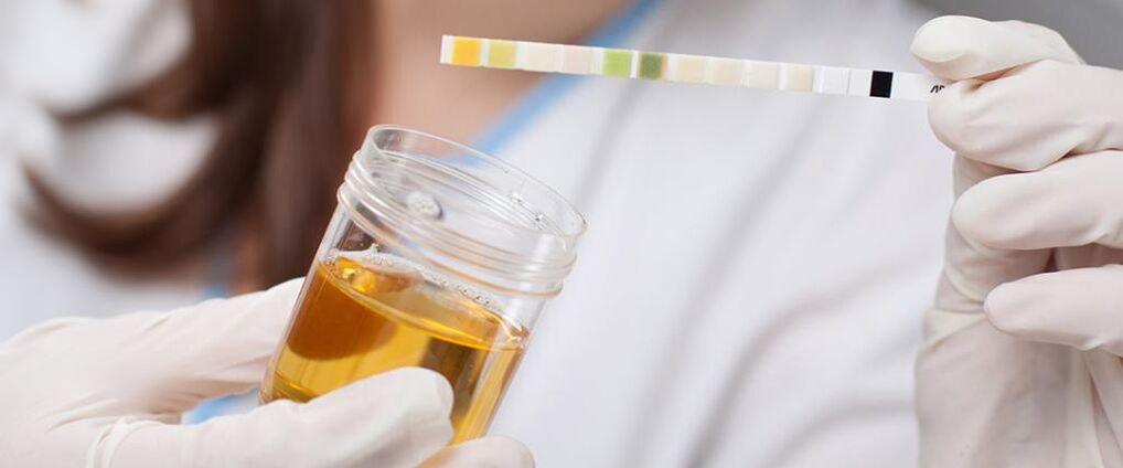 urinalysis for prostate